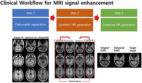 Frontiers Signal Enhancement Of Low Magnetic Field Magnetic Resonance