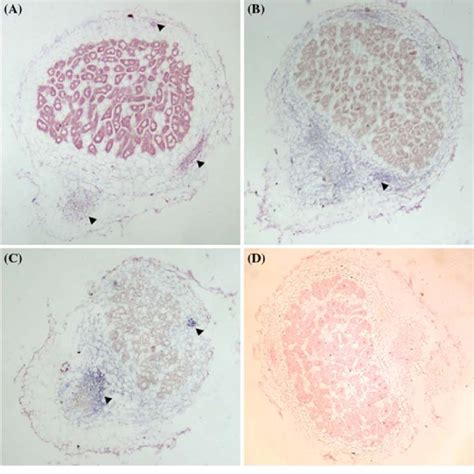 In Situ Localization Of Ljamt11 Transcript In Nodules Of Wild Type And