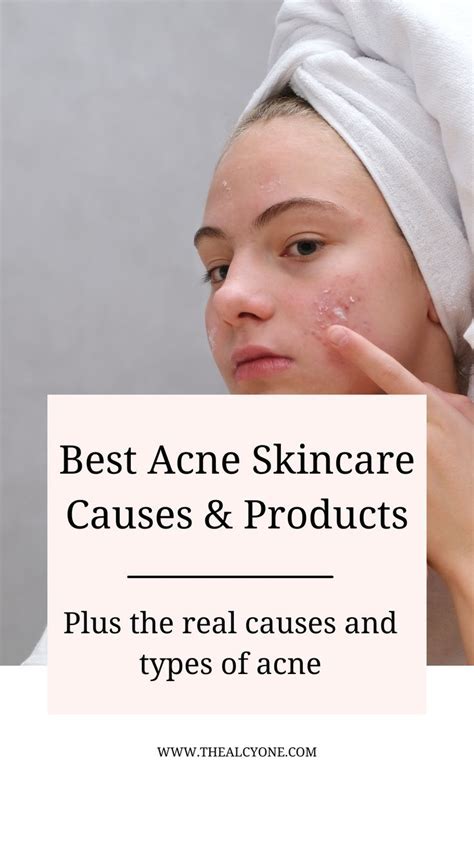 Top 10 Common Cause Of Acne And Treatments Artofit