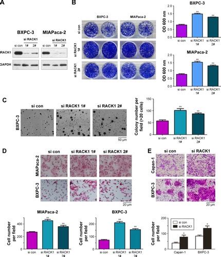 Full Article Downregulated Expression Of Rack Results In Pancreatic