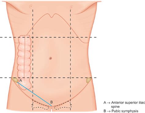 Pubic Tubercle Surface Anatomy Clinical Skills Unit Educational Loops ...