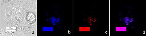 Colocalization Images Of One Hela Cell Incubated With M Of W For