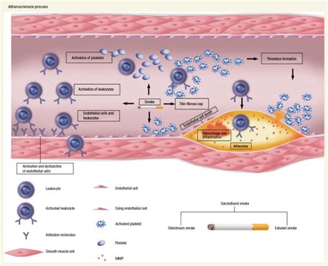 Figure Pathophysiological Mechanisms Of Tobacco Associated