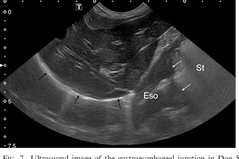 Gastroesophageal Junction Ultrasound