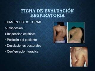 clase 5 EVALUACIÓN FISIOTERAPEUTICA RESPIRATORIA Autoguardado ppt