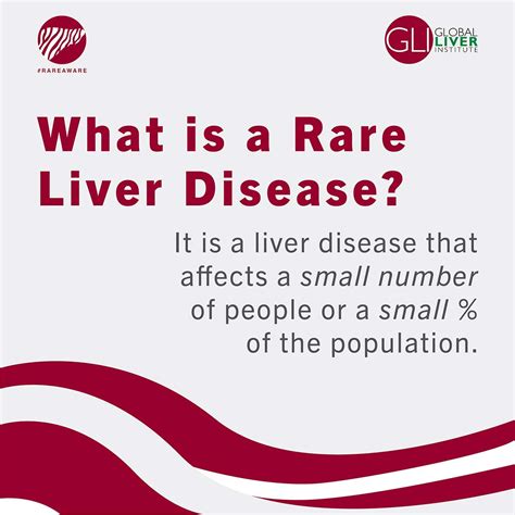 Rare Liver Diseases Month Toolkit Global Liver Institute