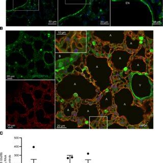 Aquaporin 5 Expression And Translocation To The Plasma Membrane In WT