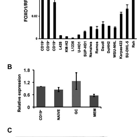 Foxo1 Expression In B Cell Subsets And In Bcl Cell Lines A Download Scientific Diagram