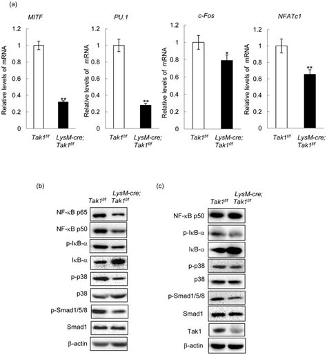 Tak1 Regulates Osteoclast Differentiation Via Multiple Transcription