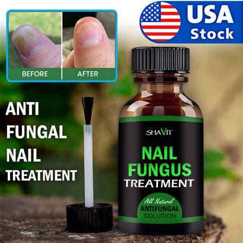 ANTI FUNGAL TREATMENT EXTRA STRENGTH TOENAIL FUNGUS ATHLETES FOOT FUNG ...