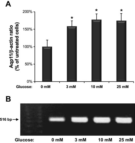 Glucose Induced Aqp Expression A Real Time Quantitative Rt Pcr