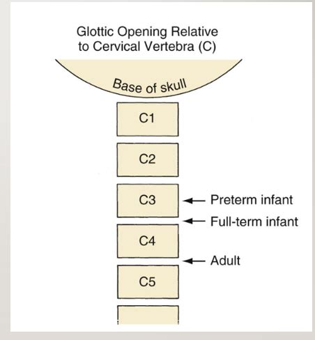 Pediatric Airway Anatomy - OpenAnesthesia