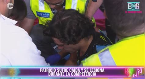 Esto Es Guerra Patricio Parodi Sufre Accidente En La Mano Al Caerle