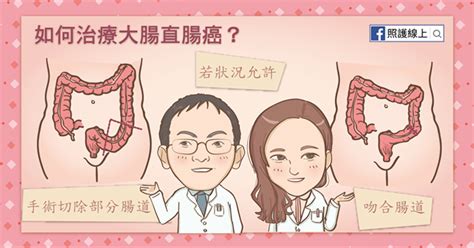 無聲殺手「大腸直腸癌」！醫師圖解治療and預防懶人包