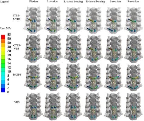 Frontiers Biomechanical Evaluation Of A Novel Anterior Transpedicular