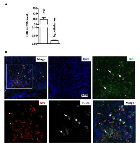 Figure 1 From Farnesoid X Receptor Activation In Brain Alters Brown