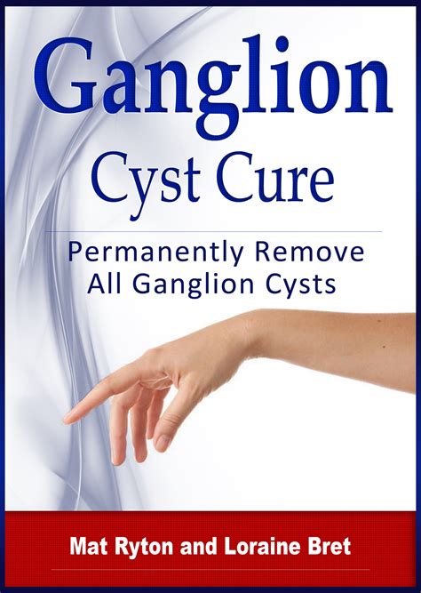 Buy Ganglion Cyst Cure: Complete guide to ganglion cyst causes, types ...