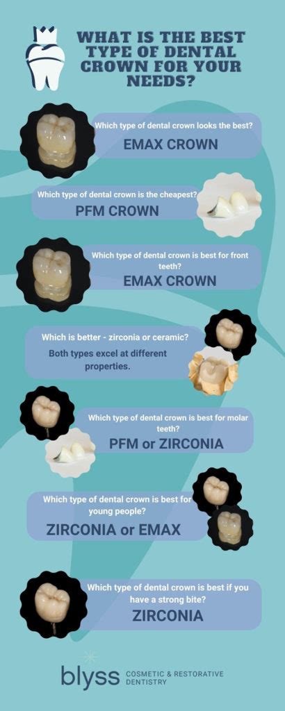 Types of Dental Crowns: Insider Tips to Choose the Best One for You