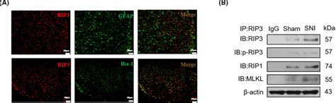 The RIP3mediated Necroptosis Pathway Promotes NP In Rats By Activating