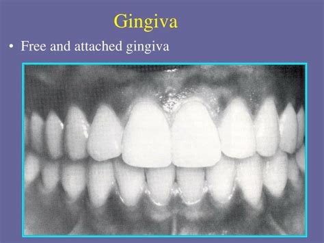 Ppt Gingival And Dentogingival Junctional Tissues Dhy Week