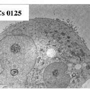 Immunofluorescence Staining Of Glioma Stem Like Cells GSCs For GFAP