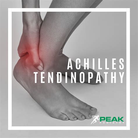 Achilles Tendinopathy Peak Podiatry