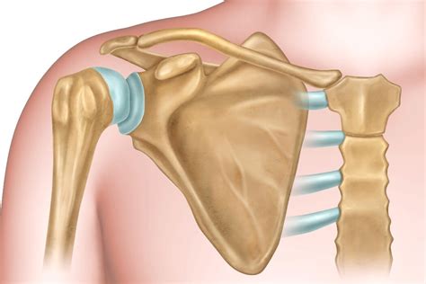 Shoulder Dislocations Causes Symptoms Treatment And Exercises