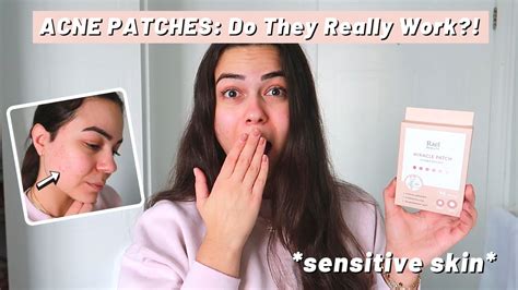 I Tried Acne Patches And This Is What Happened Hydrocolloid Patches For Pimples Sensitive