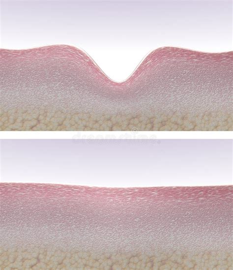 Wrinkled And Smooth Skin Cross Section 3d Render Stock Illustration