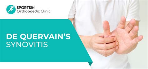 De Quervain S Synovitis Sportsin Orthopaedic Clinic