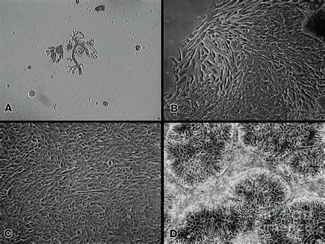 Human Mammary Epithelial Cell Cultures Photograph By Dr Robert