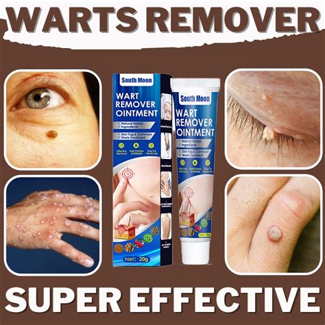 Warts Remover Original Kulugo Remover Cream Skin Tag Remover Natural