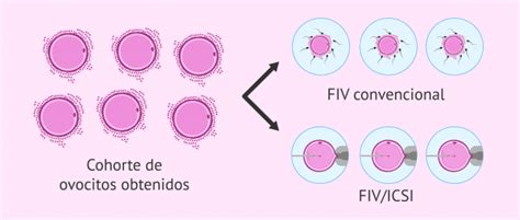 Ciclo Mixto Fiv Icsi