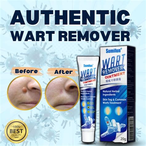 Warts Remover Original Mole Remover Cream Skin Tag Remover Original