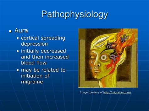 PPT - Migraine PowerPoint Presentation, free download - ID:6651819