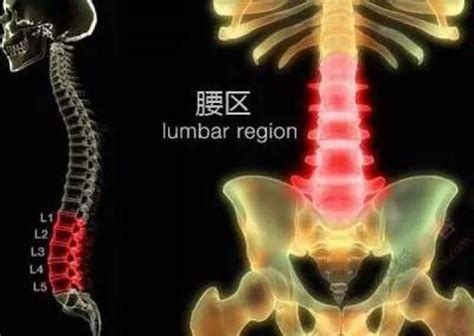 腰肌劳损骶棘肌位置图 骶棘肌位置示意图 腰肌劳损压痛点位置图 大山谷图库