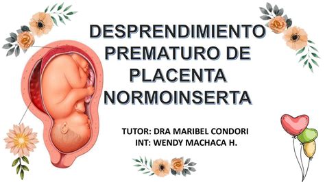 Desprendimiento Prematuro De Placenta Normoinserta Fernanda Gurgel