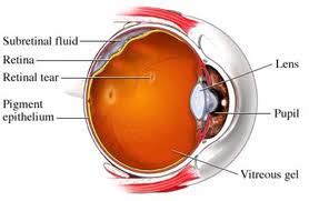 detached retina surgery