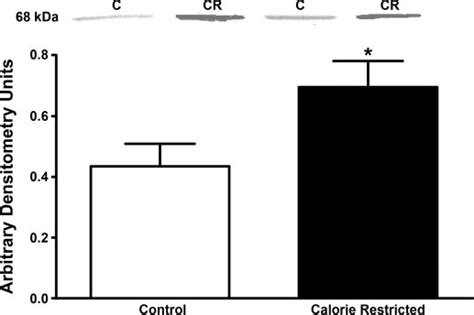 Effect Of Calorie Restriction On SREBP 1 Mature Protein In Vastus