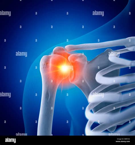 Coracoid Process Stock Photos & Coracoid Process Stock Images - Alamy