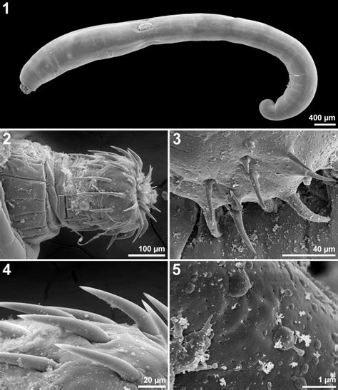 Sem Of Specimens Of Pseudoacanthocephalus Lutzi From Chaunus Limensis