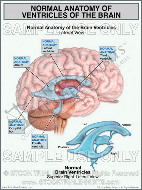 Brain Ventricles Normal Anatomy – Stock Trial Exhibits