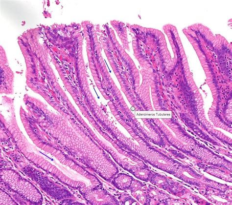 Tejido Epitelial Glandular Laboratorio De Biología Interactiva