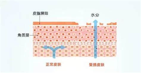 皮肤屏障受损了怎么办？如何修复皮肤屏障？敏感肌恢复手册！ 知乎