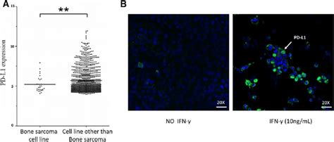 Expression Of Pd L1 On The Surface Of Osteosarcoma Cells Drawing From