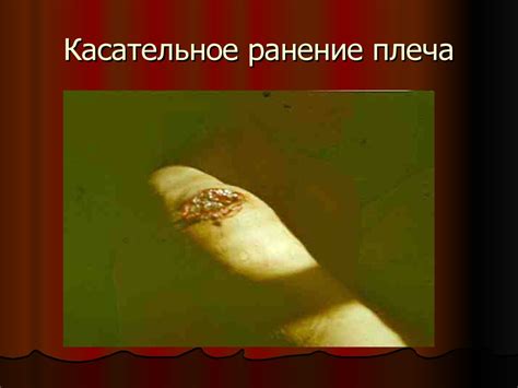 Огнестрельные ранения. Хирургическая обработка огнестрельных ран ...