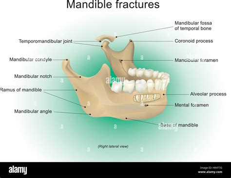 Long Jaw Mandible