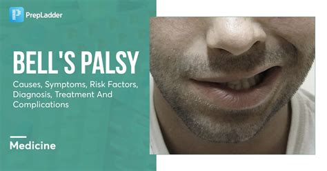 Bell S Palsy What It Is Causes Symptoms Treatment Face On