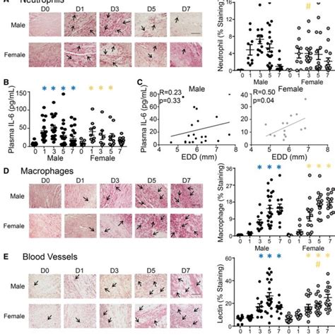Of Sex Dependent Differences In Cardiac Remodeling After Myocardial