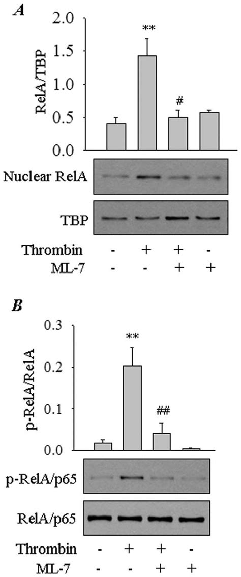 Role Of Nmmlck In Thrombin Induced Relap65 Nuclear Translocation And